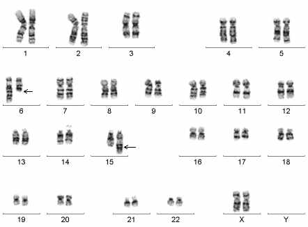 Indication for Cytogenetics Analysis