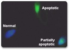 SPERM APOPTOSIS BY TUNEL METHOD