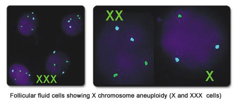 FOLLICULAR FLUID FISH