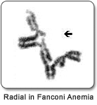 CHROMOSOMAL BREAKAGE STUDIES