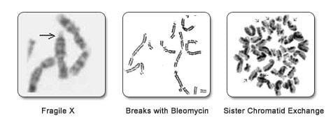 CHROMOSOMAL BREAKAGE STUDIES