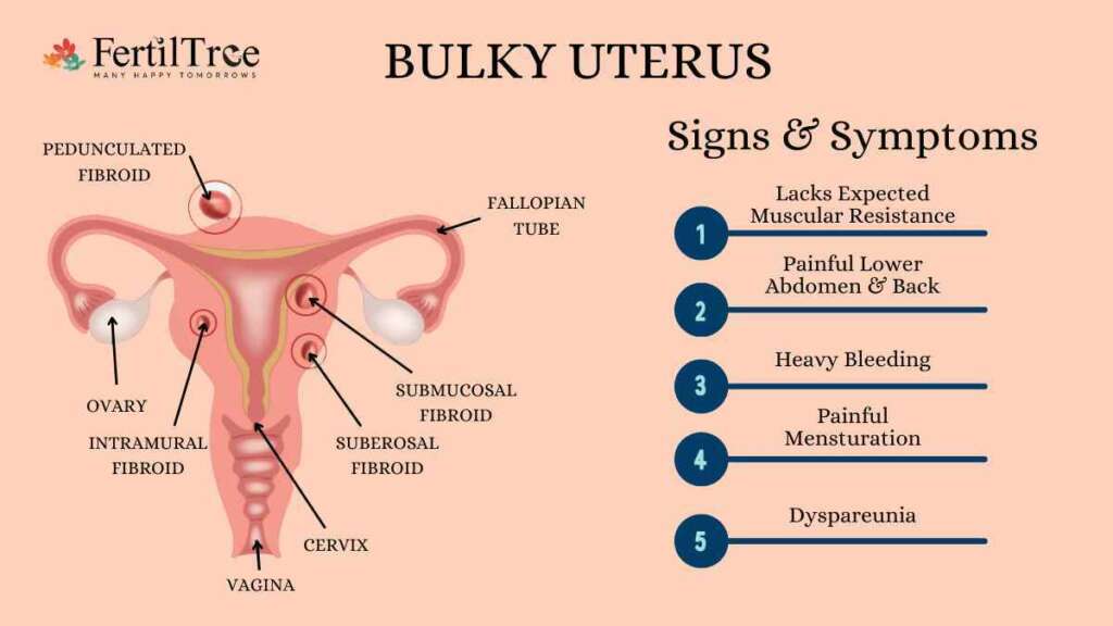 bulky uterus and its symptoms