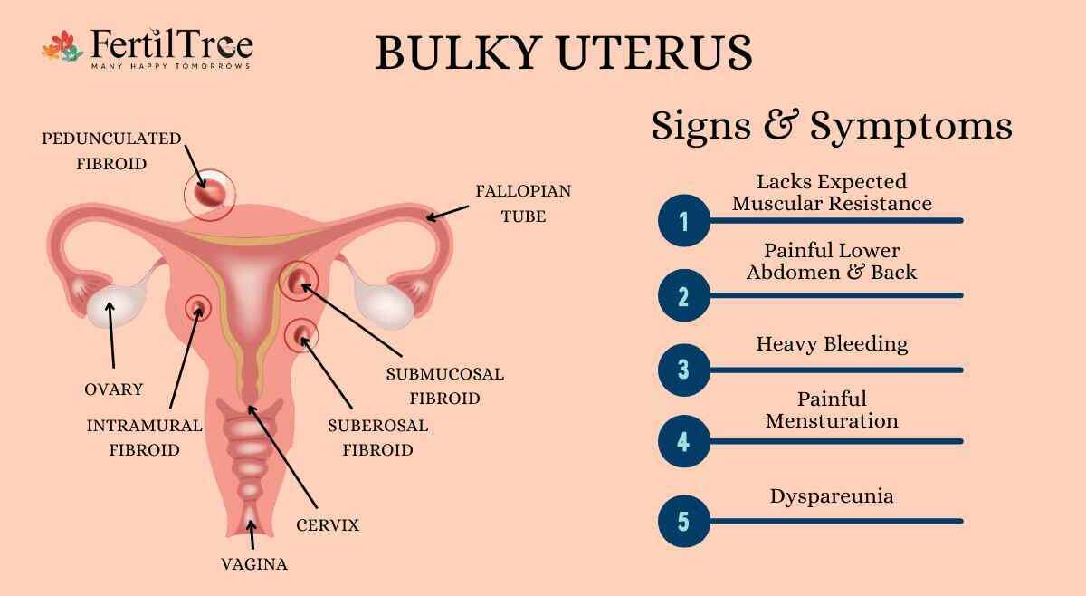 Symptoms of Bulky Uterus