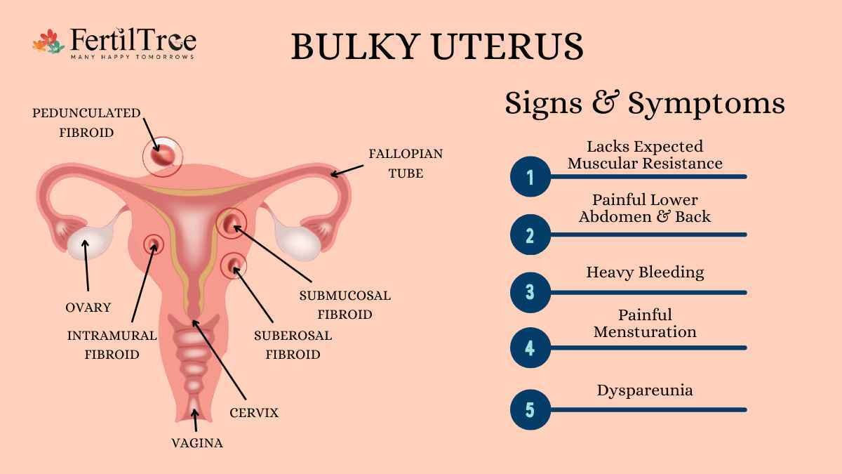 Bulky Uterus Symptoms Causes And Treatment