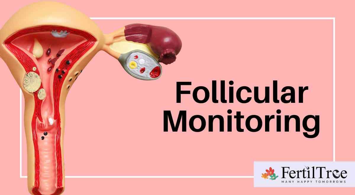 follicular monitoring