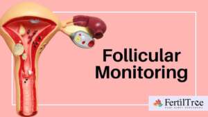 follicular monitoring