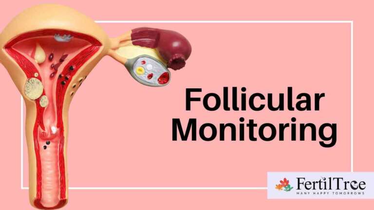 free fluid in pod means in follicular study