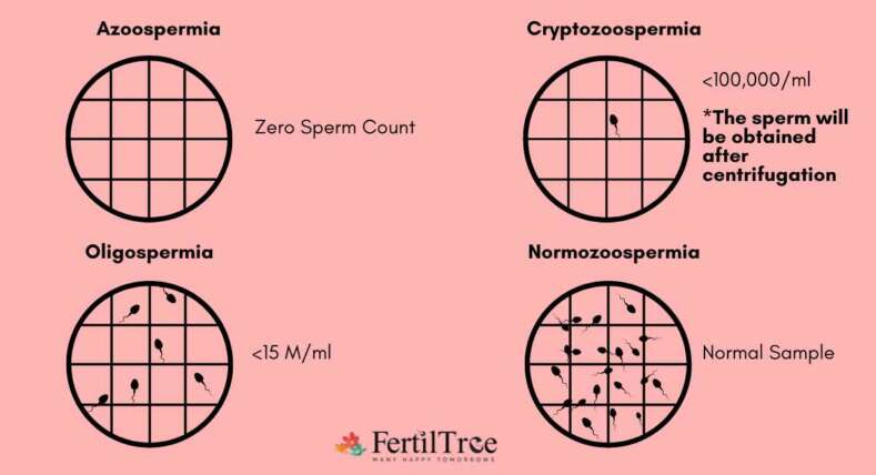 Thin Endometrium Lining  Symptoms, Causes & Treatments
