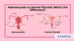 adenomyosis vs uterine