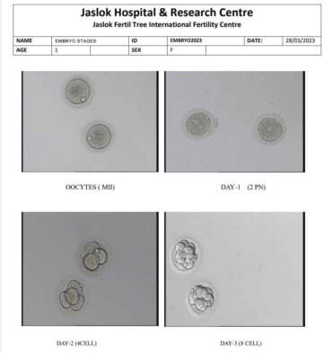 What Is Embryo Grading? Day 3, Day 5, Success Rates - Fertiltree