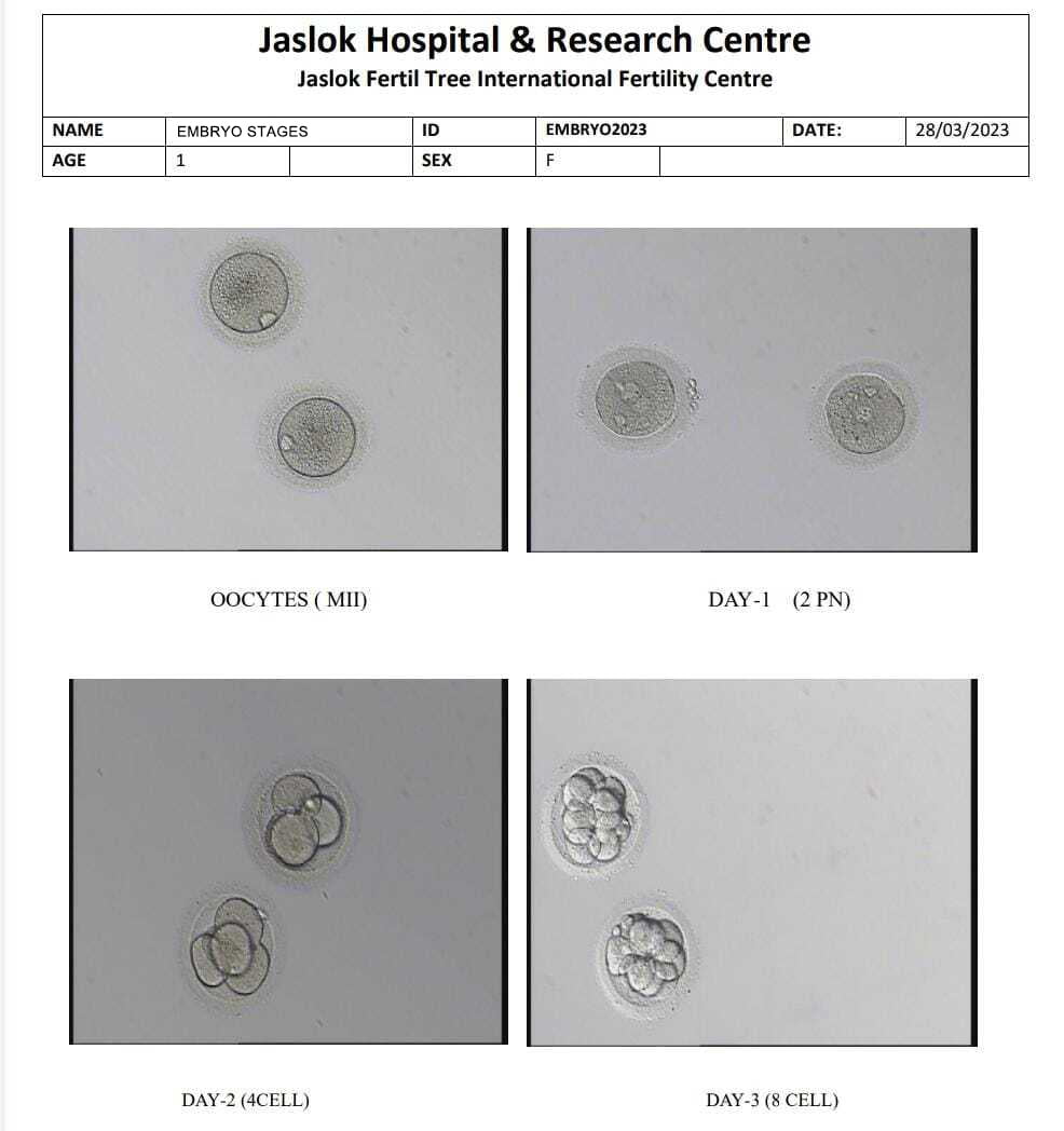 What Is Embryo Grading? Day 3, Day 5, Success Rates - Fertiltree