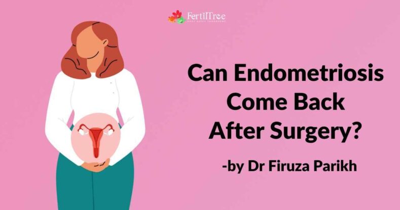 How Quickly Can Endometriosis Grow Back After Surgery