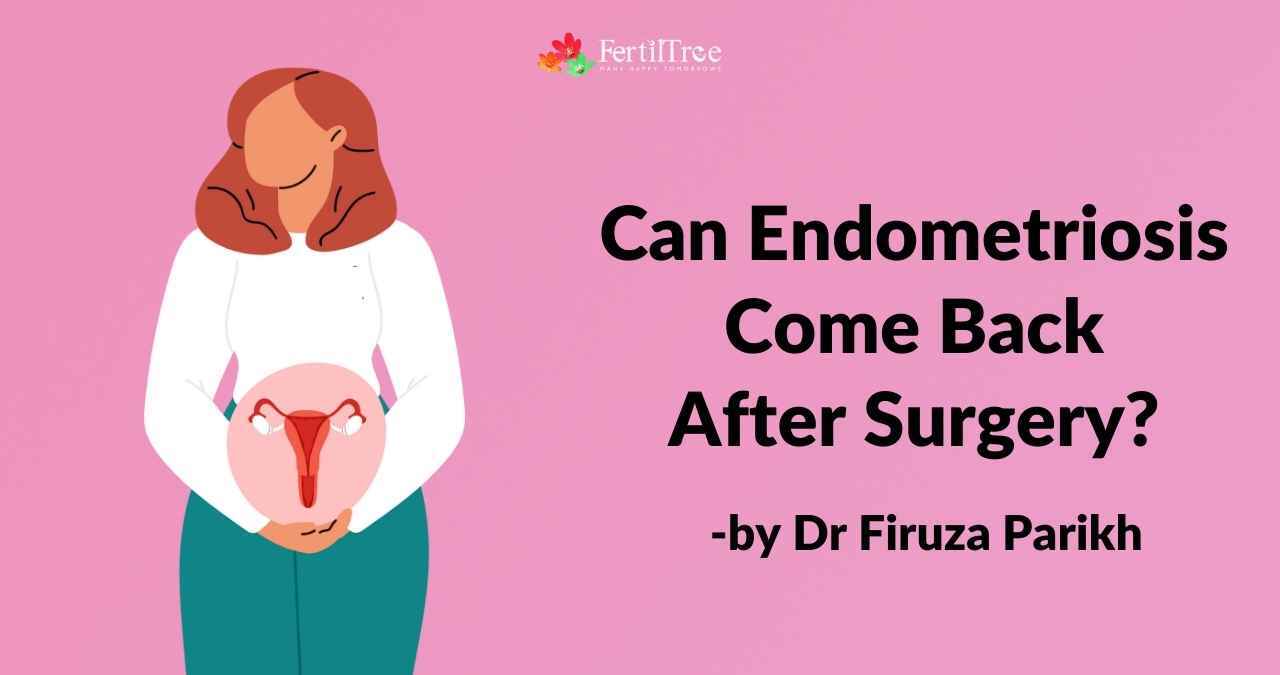 what causes endometriosis, Several Proposed Theories